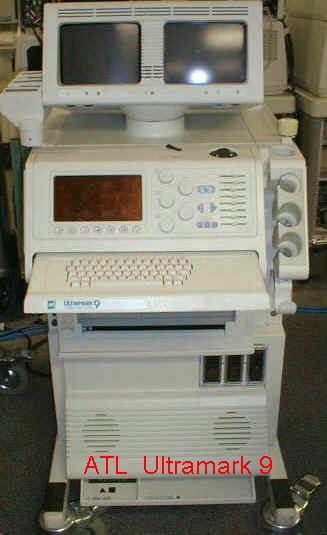 Ultamark 9 hdi