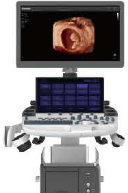 Sonoscape P40 Elite nuovo