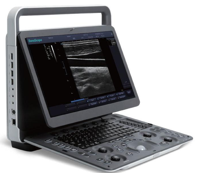 Sonoscape E1 expert 3 connettori portatile
